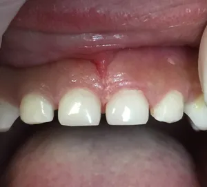 Patient 2 after treatment