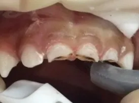 Patient 3 after treatment