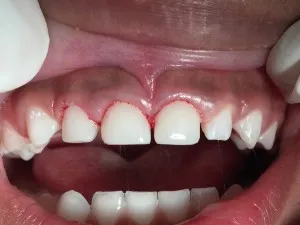 Patient 5 after treatment
