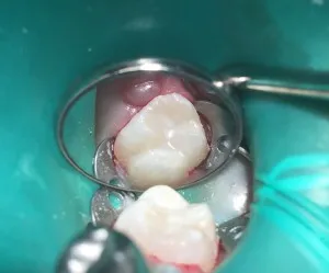 Patient 7 after treatment
