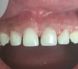 Patient 8 after treatment